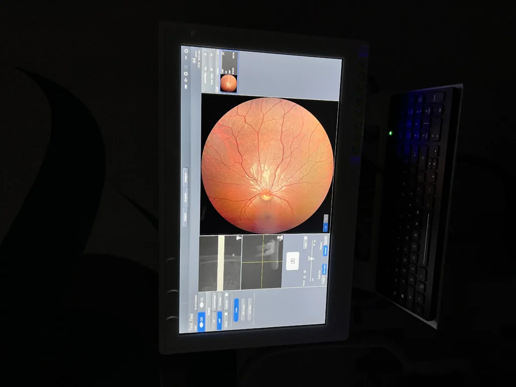 Carl Zeiss Clarus 500 Ultra-Widefield Fundus Camera w/ Windows 10 & FAF, photo 2