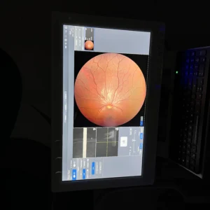 Carl Zeiss Clarus 500 Ultra-Widefield Fundus Camera w/ Windows 10 & FAF, photo 2